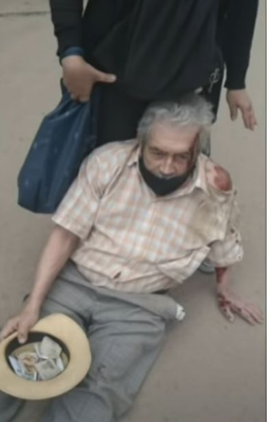Anciano en bicicleta fue arrollado por ambulancia Repudio e indignación ha causado un video que rueda por las redes sociales, en el que se ve el momento en el que una ambulancia atropella a un adulto mayor de 85 años que se movilizaba en bicicleta por una calle del sur de la ciudad.