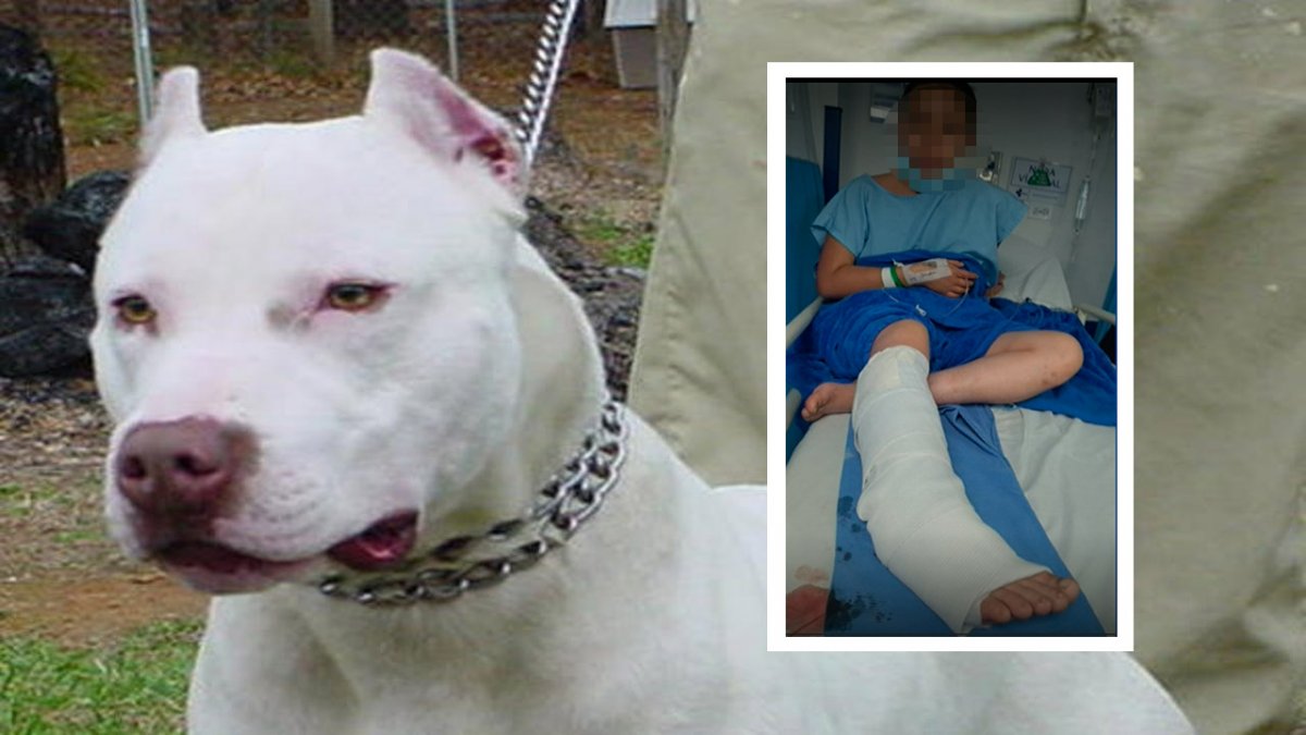 Jovencita fue atacada por un perro pitbull en Bosa Una menor de edad fue atacada por un perro de raza pitbull cuando salía de un establecimiento comercial en la localidad de Bosa. Según la madre de la afectada, está hospitalizada en un centro médico del occidente de Bogotá, ya que las heridas fueron de gravedad.