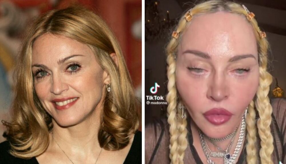 Acusan a Madonna de drogarse en vivo La reina del pop, Madonna, fue criticada en redes sociales tras aparecer en una transmisión en vivo inhalando un frasco. La escena causó furor porque muchos aseguraron que se trataba de popper.