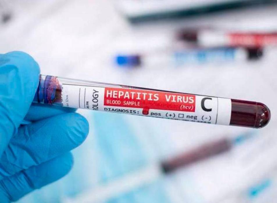 Confirman primer caso de hepatitis aguda en Colombia ¿Cómo se contagia? Luego que Colombia confirmara el primer caso de hepatitis aguda de origen desconocido, el Instituto Nacional de Salud (INS) informó cuales son los signos de alarma de la enfermedad.