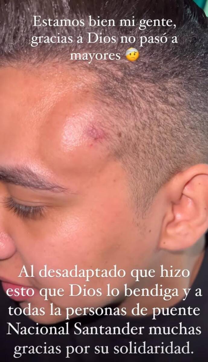 Ana del Castillo se emberracó porque agredieron a su acordeonero La cantante de vallenato Ana del Castillo, de 23 años, se enfureció cuando en plena presentación le lanzaron un objeto a su acordeonero en la cabeza.
