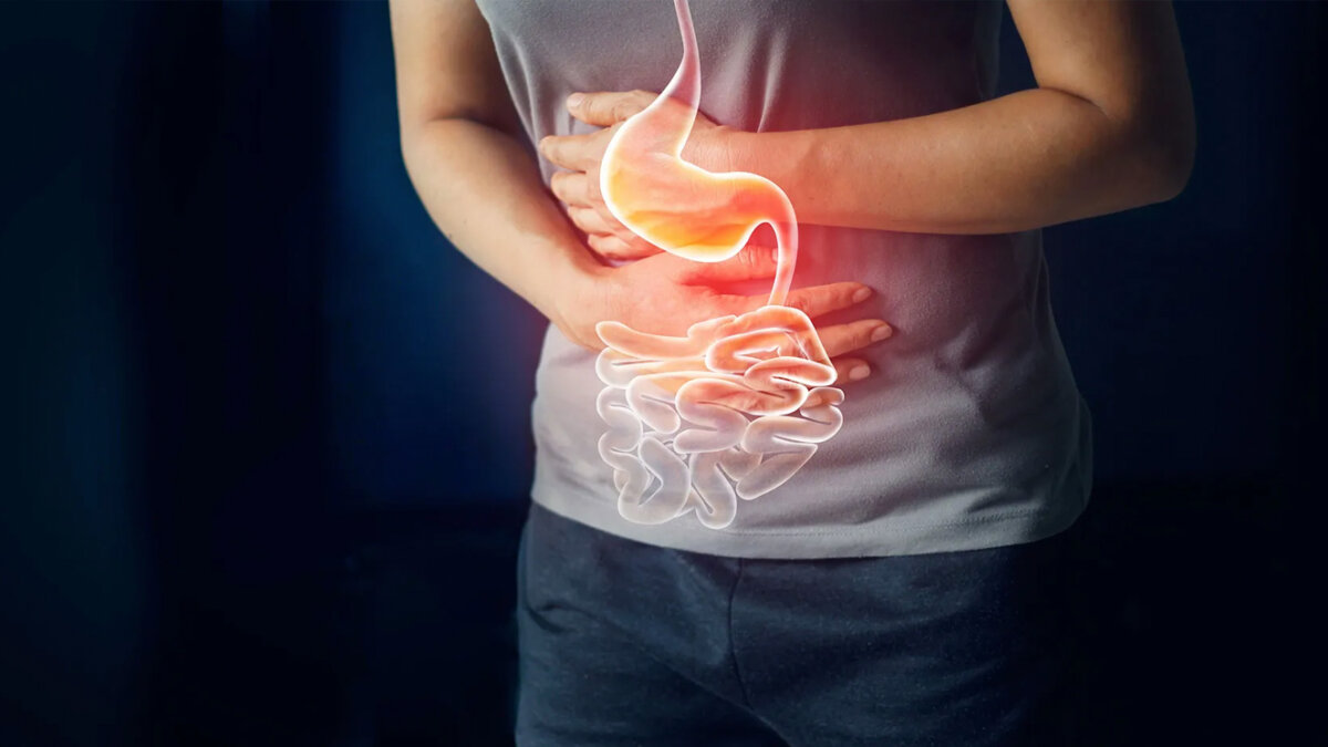 La molesta indigestión * Endoscopia para comprobar si hay anomalías en tu tracto digestivo superior, sobre todo en personas mayores con síntomas más persistentes. Es posible que te tomen una muestra de tejido (biopsia) para un análisis. 