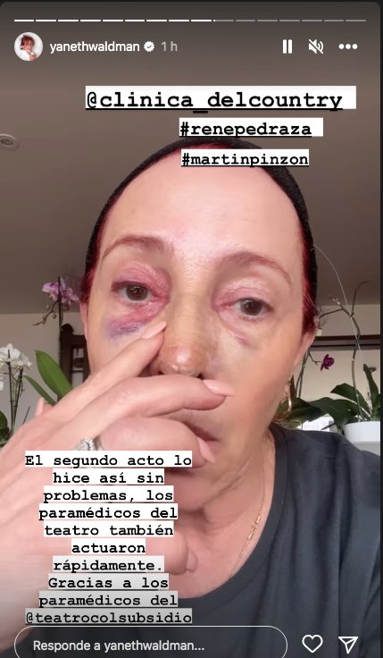 Las graves fracturas que sufrió Yaneth Waldman en su rostro Le contamos por qué la actriz y presentadora Yaneth Waldman terminó en el quirófano.