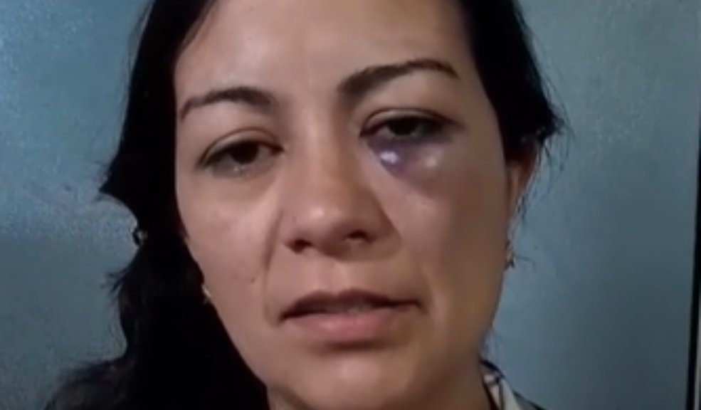 Profesora denuncia haber sido golpeada por una estudiante de un colegio en Fontibón La profesora denunció haber sido golpeada por una de sus alumnas.