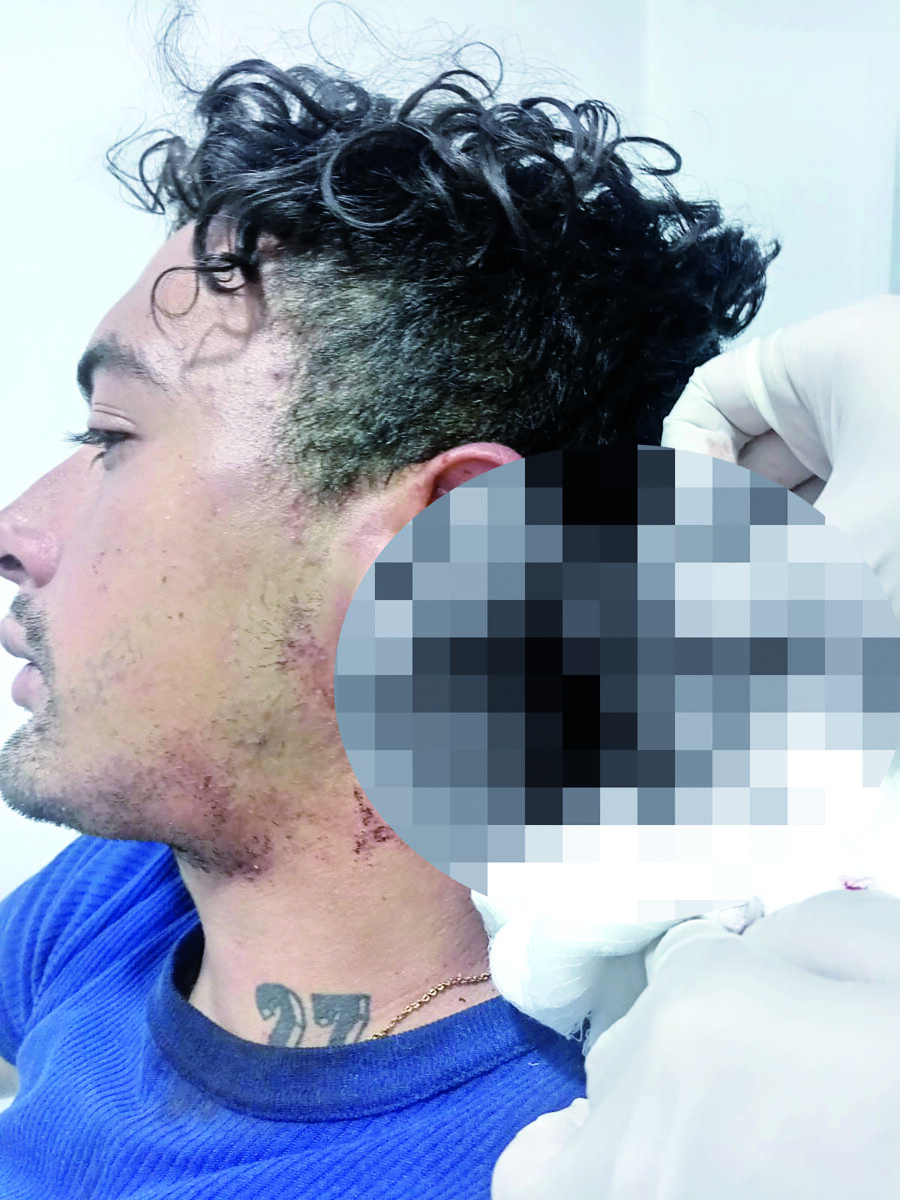 Brutal agresión en La Candelaria José Daniel Sabogal, de 26 años, fue víctima de una brutal agresión en el barrio Belén, en La Candelaria.