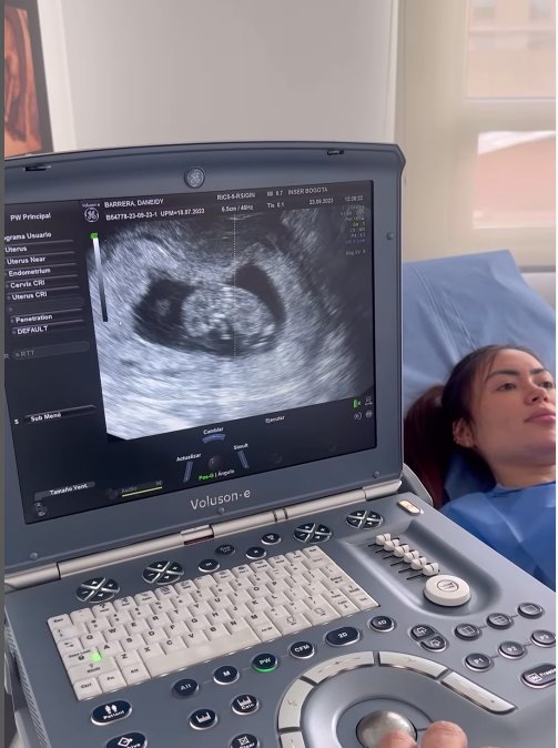 Epa Colombia confirmó su embarazo: será mamá de una niña Por medio de un vídeo en su perfil de Instagram, Daneidy Barrera, más conocida como 'Epa Colombia', confirmó que será mamá de una niña.