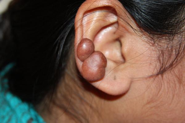 Pilas con las perforaciones de orejas Tenga en cuenta las siguientes recomendaciones a la hora de hacerse una perforación en la oreja.