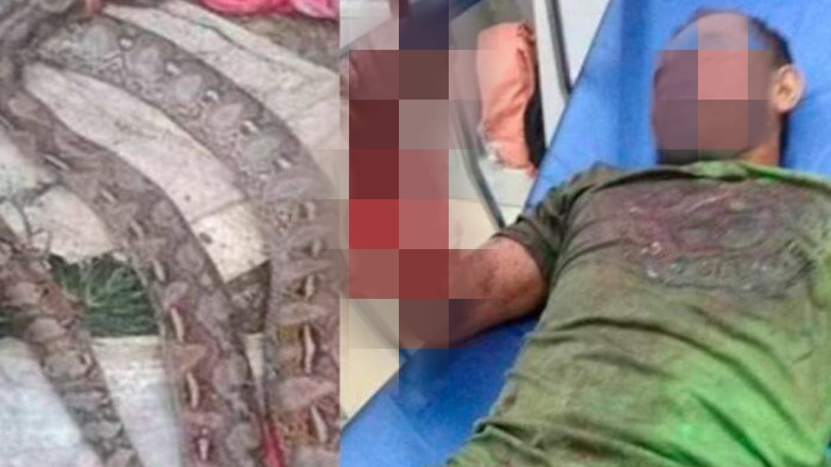 Un hombre escapó a punta de mordiscos del ataque de una serpiente El filipino Boljulio Aleria, de 48 años, enfrentó valientemente a una serpiente pitón que lo atacó mientras circulaba en moto