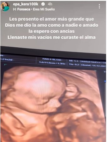 ¡Qué belleza! Epa Colombia mostró por primera vez el rostro de su bebé La reconocida influencer y empresaria de Keratina Epa Colombia no puede ocultar la felicidad que siente por la pronta llegada de su bebé.
